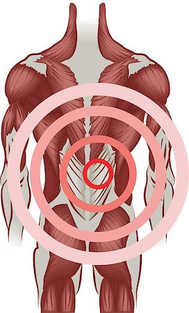 Muscles of the back radiating pain. No meshes used. Stock Photo - Budget Royalty-Free & Subscription, Code: 400-04429052