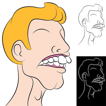 deformity - An image of a man with a dental overbite. Foto de stock - Super Valor sin royalties y Suscripción, Código: 400-04422189