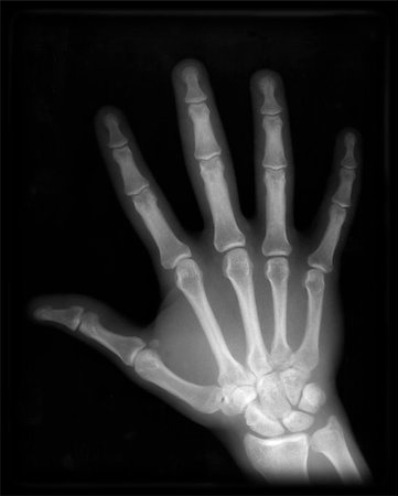 x-ray hand Foto de stock - Super Valor sin royalties y Suscripción, Código: 400-04423272