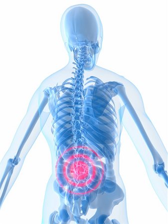 simsearch:400-04163427,k - 3d rendered anatomy illustration of a human skeleton with a painful spine Stockbilder - Microstock & Abonnement, Bildnummer: 400-04486960