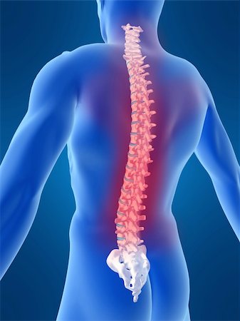 3d rendered anatomy illustration of a human spine with pain Stock Photo - Budget Royalty-Free & Subscription, Code: 400-04480737