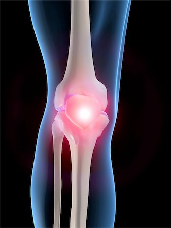 simsearch:400-04191634,k - 3d rendered anatomy illustration of a human knee wiith pain Foto de stock - Royalty-Free Super Valor e Assinatura, Número: 400-04480952