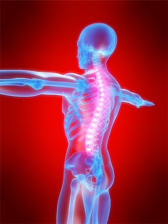 simsearch:400-04163427,k - 3d rendered anatomy illustration of a human skeleton with a painful spine Stockbilder - Microstock & Abonnement, Bildnummer: 400-04480994