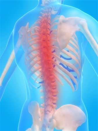simsearch:400-04008303,k - 3d rendered anatomy illustration of a human skeleton with a painful spine Stockbilder - Microstock & Abonnement, Bildnummer: 400-04480992