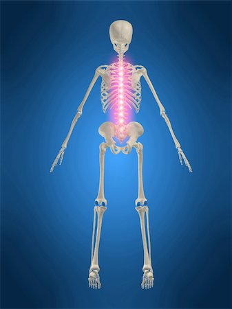 simsearch:400-04163427,k - 3d rendered anatomy illustration of a human skeleton with a painful spine Stockbilder - Microstock & Abonnement, Bildnummer: 400-04481005