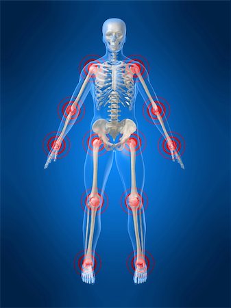 simsearch:400-04008303,k - 3d rendered anatomy illustration of a human skeleton with painful joints Stockbilder - Microstock & Abonnement, Bildnummer: 400-04482948