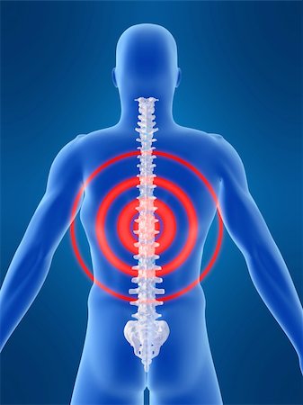simsearch:400-04163427,k - 3d rendered anatomy illustration of a human shape with a painful spine Stock Photo - Budget Royalty-Free & Subscription, Code: 400-04482959