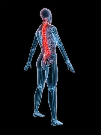 simsearch:400-04008303,k - 3d rendered anatomy illustration of a human skeleton with a painful spine Stockbilder - Microstock & Abonnement, Bildnummer: 400-04499876