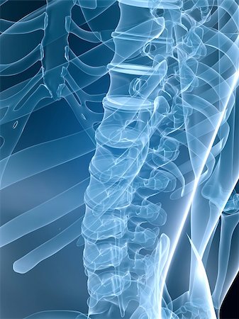 simsearch:400-04003518,k - 3d rendered x-ray illustration of a human skeletal back Fotografie stock - Microstock e Abbonamento, Codice: 400-04500613