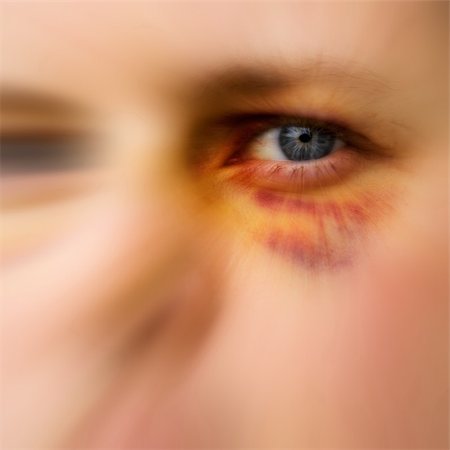 simsearch:400-07313485,k - Black eye detail of a woman - purple yellow and black Stock Photo - Budget Royalty-Free & Subscription, Code: 400-04517555