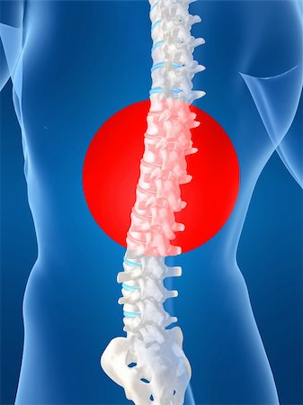 simsearch:400-04008303,k - 3d rendered anatomy illustration of a human shape with a painful spine Stockbilder - Microstock & Abonnement, Bildnummer: 400-04518153