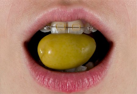 A green olive about to be eaten for a woman with braces. Foto de stock - Super Valor sin royalties y Suscripción, Código: 400-04529515