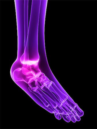 3d rendered x-ray illustration of a human painful foot Stock Photo - Budget Royalty-Free & Subscription, Code: 400-04545754