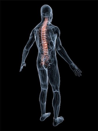 simsearch:400-04008303,k - 3d rendered anatomy illustration of a transparent body with backache Stockbilder - Microstock & Abonnement, Bildnummer: 400-04549735