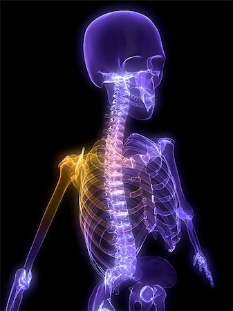 simsearch:400-04391285,k - 3d rendered anatomy illustration of a painful human shoulder Photographie de stock - Aubaine LD & Abonnement, Code: 400-04553837