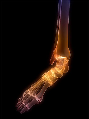 3d rendered anatomy illustration of a painful human foot Stock Photo - Budget Royalty-Free & Subscription, Code: 400-04553840