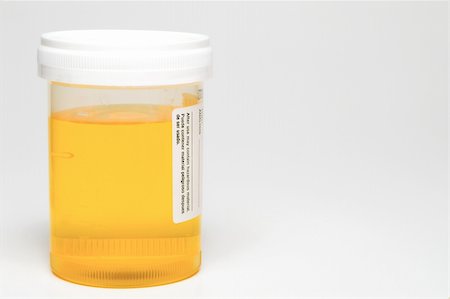 A fresh urine sample in a medical container. Stock Photo - Budget Royalty-Free & Subscription, Code: 400-04560906
