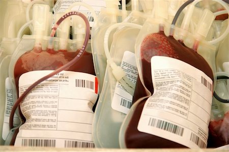 Details shot of platelet concentrate, Human blood in storage Stock Photo - Budget Royalty-Free & Subscription, Code: 400-04561815