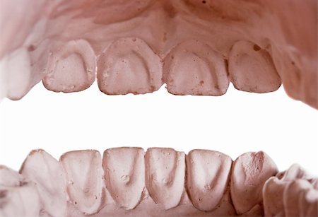 gypsum model of a human teeth on white background Stockbilder - Microstock & Abonnement, Bildnummer: 400-04577384