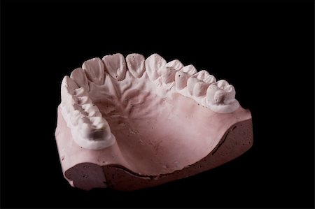 gypsum model of a human teeth on black background Stockbilder - Microstock & Abonnement, Bildnummer: 400-04577381