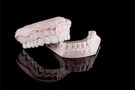 gypsum model of a human teeth on black background Stockbilder - Microstock & Abonnement, Bildnummer: 400-04577383