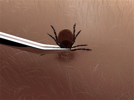 3d rendered illustration of a tick on the skin Stock Photo - Budget Royalty-Free & Subscription, Code: 400-04573083