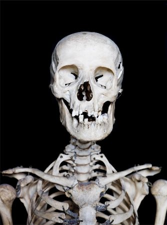 skeletons human not illustration not xray - Skull with short focal depth towards black background Stock Photo - Budget Royalty-Free & Subscription, Code: 400-04604605