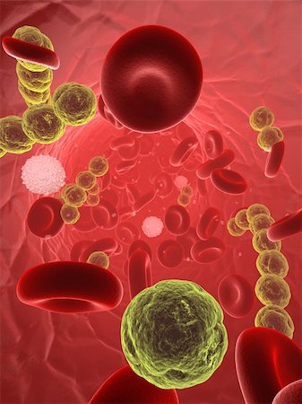streptococcus - 3d rendered illustration of an artery with blood cells and streptococcus bacteria Stock Photo - Budget Royalty-Free & Subscription, Code: 400-04602173