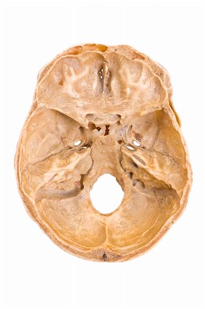 simsearch:400-05336507,k - A cranium (skull) with a cut down calvaria (the top side of it) with well represented anatomic formations - upper view. Stockbilder - Microstock & Abonnement, Bildnummer: 400-04616908