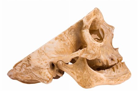 simsearch:400-05336507,k - A lateral view of a cranium with a cutdown calvaria (the top side of it) - Good visible anatomic formations. Stockbilder - Microstock & Abonnement, Bildnummer: 400-04616909