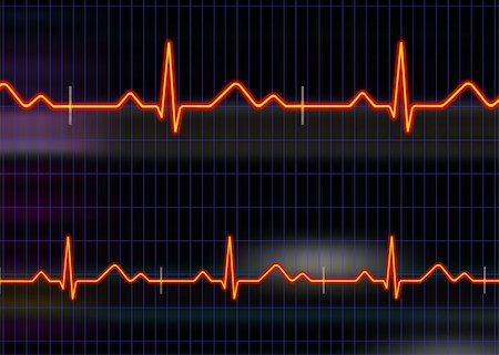 simsearch:400-03917668,k - Cardiogram illustration with grid background Photographie de stock - Aubaine LD & Abonnement, Code: 400-04613338