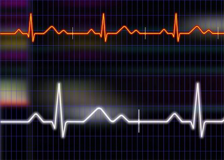 simsearch:400-05288227,k - Cardiogram illustration with grid background Stock Photo - Budget Royalty-Free & Subscription, Code: 400-04613339