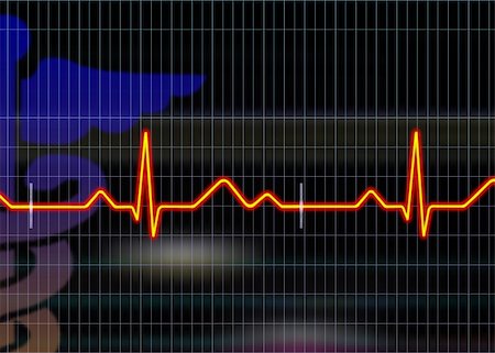 radio sign - Cardiogram illustration with grid background Stock Photo - Budget Royalty-Free & Subscription, Code: 400-04613341