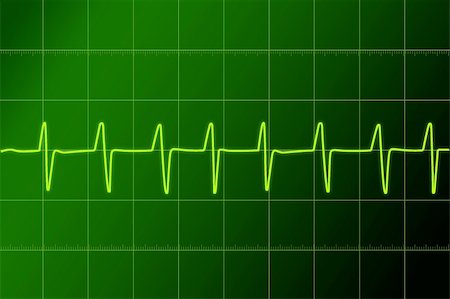 Electronic cardiogram illustration. Cardiogram  and hospital concept illustration. Foto de stock - Super Valor sin royalties y Suscripción, Código: 400-04632678