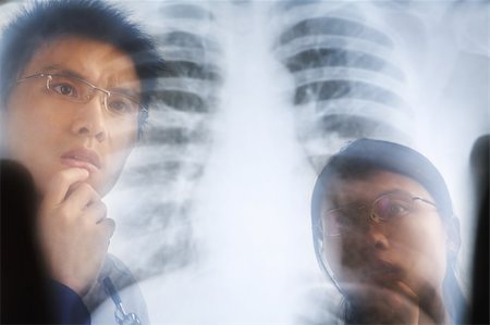 Asian doctor examining xray negative / roentgen print. PS:the image taken from behind the xray print, so it may leave some soft noise on the people image behind it. Stock Photo - Budget Royalty-Free & Subscription, Code: 400-04653707