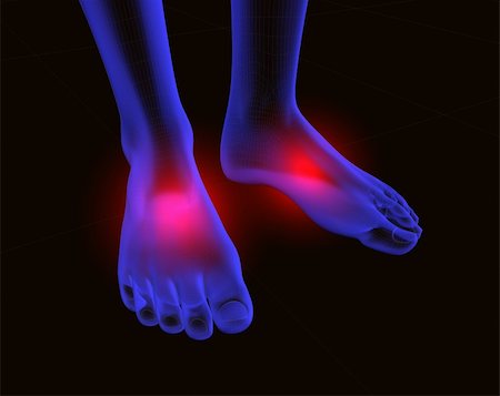 3d image of feet with red pain Stock Photo - Budget Royalty-Free & Subscription, Code: 400-04690807