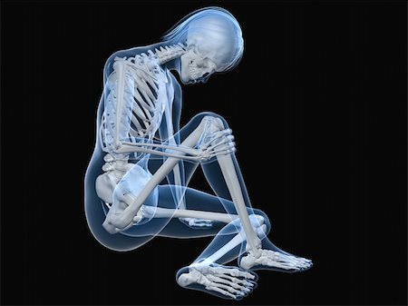 simsearch:400-04191634,k - 3d rendered illustration of a sitting female skeleton with painful knee Foto de stock - Royalty-Free Super Valor e Assinatura, Número: 400-04693030