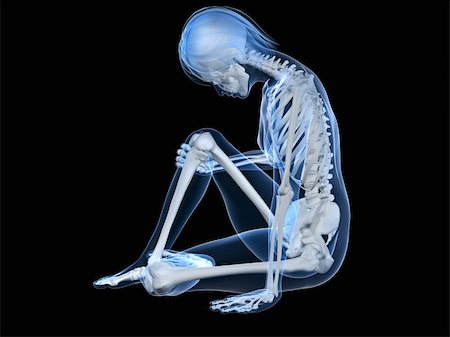 simsearch:400-07088080,k - 3d rendered illustration of a sitting female skeleton with painful knee Stock Photo - Budget Royalty-Free & Subscription, Code: 400-04693031