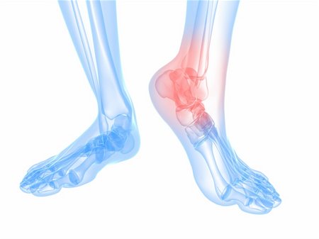 sore feet - 3d rendered illustration of a skeletal foot with highlighted ankle Stock Photo - Budget Royalty-Free & Subscription, Code: 400-04693071