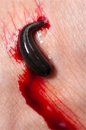 simsearch:649-09003663,k - Leech sucking blood from a leg in tropical rainforest, Malaysia, Asia. Photographie de stock - Aubaine LD & Abonnement, Code: 400-04716205