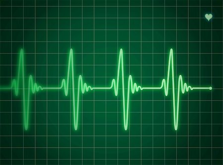 Green electrocardiogram Foto de stock - Super Valor sin royalties y Suscripción, Código: 400-04774520