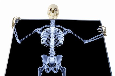 simsearch:400-09000460,k - skeleton under the X-rays through the screen. Stock Photo - Budget Royalty-Free & Subscription, Code: 400-04784621