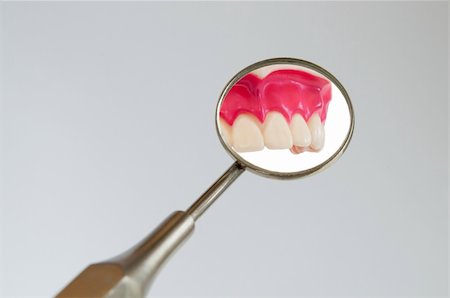 Teeth in the dentist's mirror Stock Photo - Budget Royalty-Free & Subscription, Code: 400-04783019