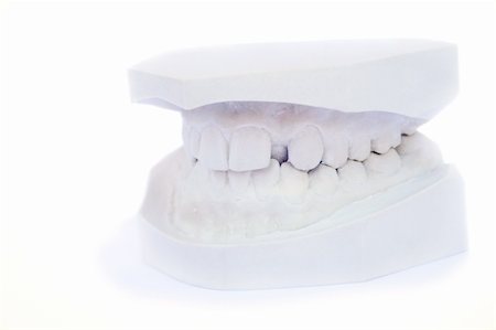dental pictures black & white - gypsum model of a human teeth. Stock Photo - Budget Royalty-Free & Subscription, Code: 400-04816416
