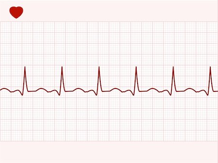 Normal electronic cardiogram. EPS 8 vector file included Stock Photo - Budget Royalty-Free & Subscription, Code: 400-04810654