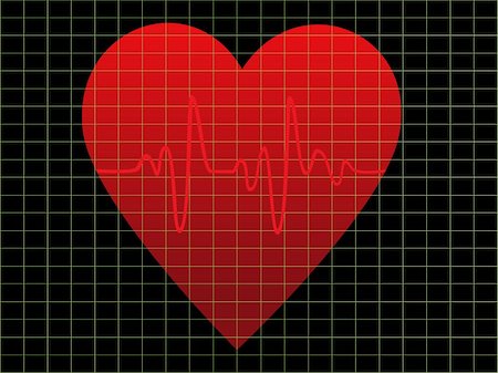 simsearch:400-04835576,k - EKG or heart beat monitor Foto de stock - Super Valor sin royalties y Suscripción, Código: 400-04835576
