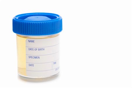 stockarch (artist) - pathology test sample jar containing a urine specimen Stock Photo - Budget Royalty-Free & Subscription, Code: 400-04838340