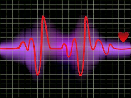 Heartbeat monitor with a heart Foto de stock - Royalty-Free Super Valor e Assinatura, Número: 400-04859008
