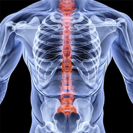 entzündung - torso men under X-rays. backbone is highlighted in red. isolated on black. Stockbilder - Microstock & Abonnement, Bildnummer: 400-04900049