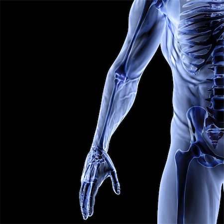 fraktur - Man's arm under x-rays. isolated on black. Stockbilder - Microstock & Abonnement, Bildnummer: 400-04900041